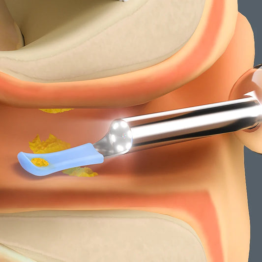 Visual Ear Camera
