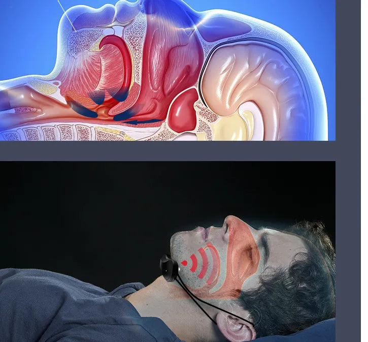 Intelligent Anti-Snoring Device